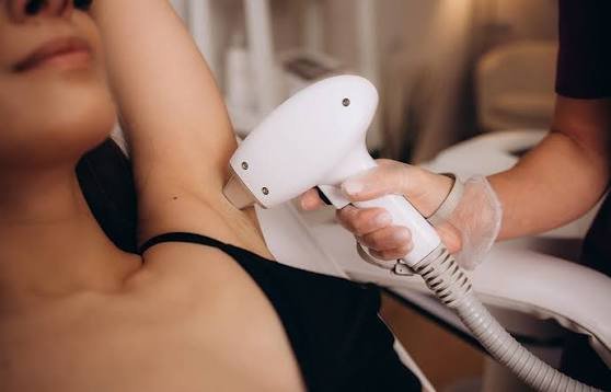 Laser hair removal service